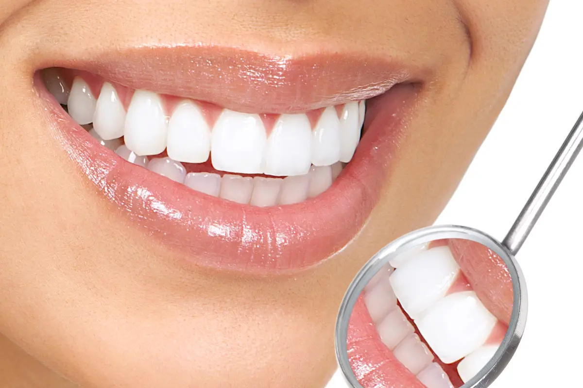 5 Lip Gloss Ajaib yang Bisa Bikin Gigi Kamu Terlihat Lebih Putih
