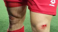 Piala AFF 2024: Pemain Vietnam Luka-Luka Buntut Main Lawan Filipina di Rumput Sintetis Rizal Memorial Stadium, Begini Penampakannya