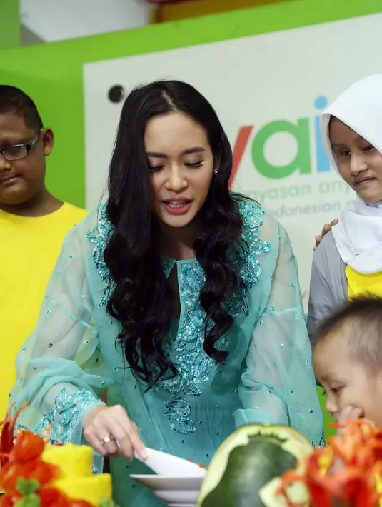 Nenek Elvira meninggal dunia akibat menderita penyakit kanker ovarium stadium tiga. Akibat kejadian itu, perempuan 23 tahun itu berjanji untuk meluangkan energi, materi maupun spiritual untuk penderita kanker. (Nurwahyunan/Bintang.com)