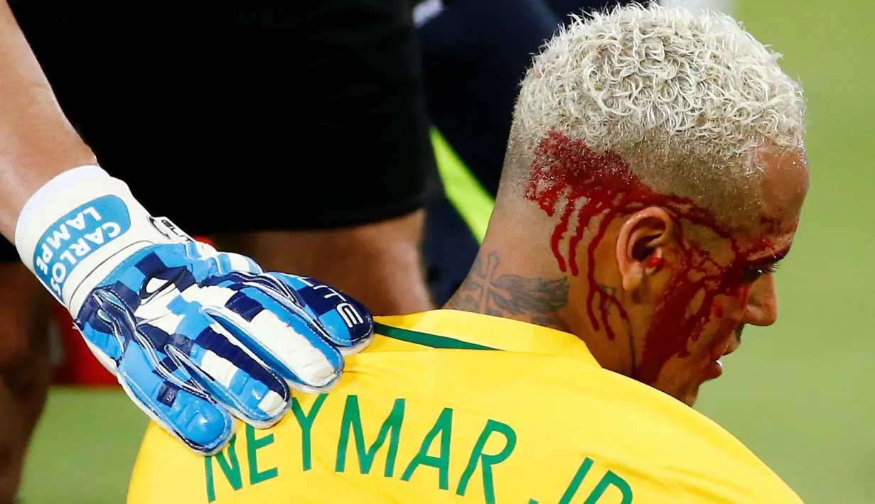 Pelipis Neymar berdarah usai bertabrakan dengan kiper Bolivia, Carlos Lampe pada laga kualifikasi Piala Dunia 2018 di Dunas Arena Stadium, Natal, Brasil, (7/10/2016).  (REUTERS/Ricardo Moraes)