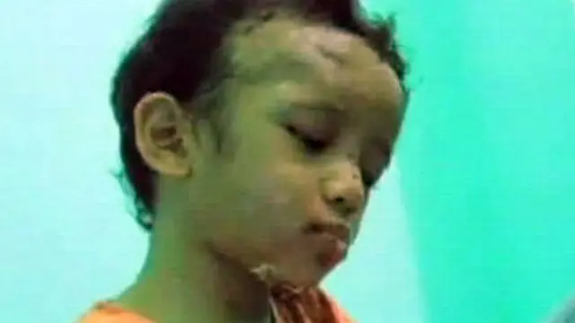 [VIDEO] Diduga Aniaya Bocah Adit, Ortu Ditangkap dan Diperiksa