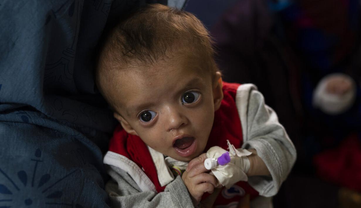 Seorang ibu menggendong bayinya saat menjalani perawatan di bangsal gizi buruk RS Anak Nasional Ataturk, Kabul, Afghanistan, 2 Desember 2021. Menurut PBB dari awal November, hampir 24 juta orang di Afghanistan, sekitar 60 persen dari populasi, menderita kelaparan akut. (AP Photo/Petros Giannakouris)