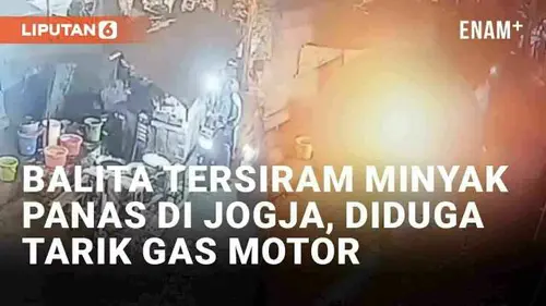 VIDEO: Viral Balita Tersiram Minyak Panas Saat Beli Gorengan di Jogja, Diduga Tarik Gas Motor yang Menyala