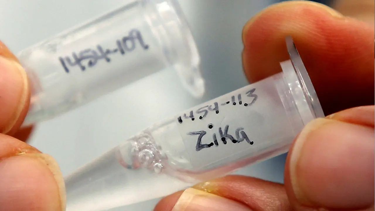 20161004-Virus-Zika-AS-Reuters