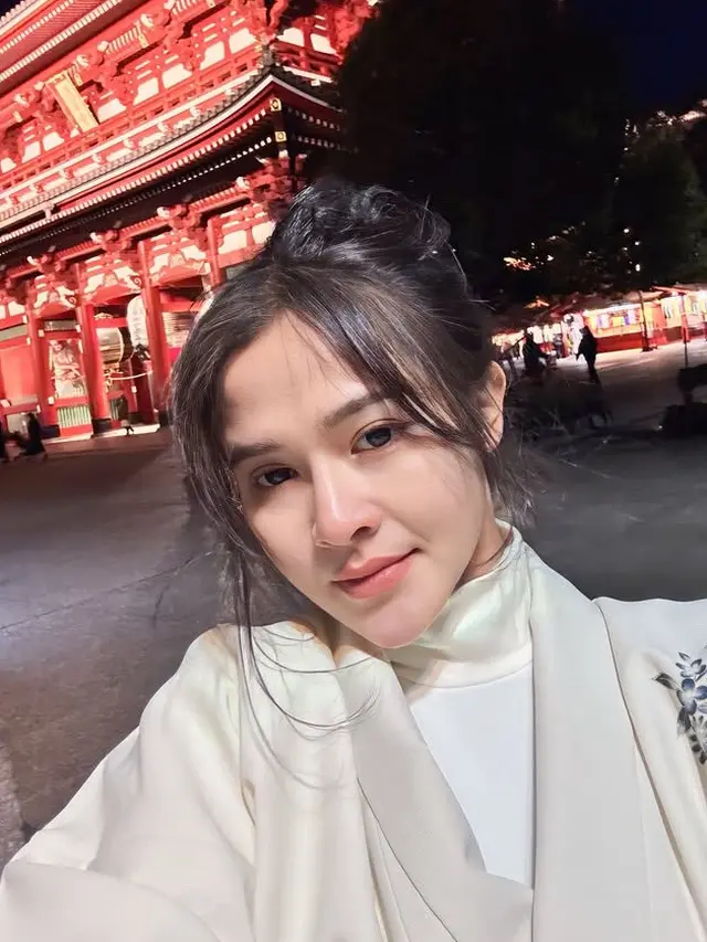 Wajah Sehat dan Glowing Bella Bonita Terungkap saat Liburan ke Jepang. [@bellabonita_r.a]