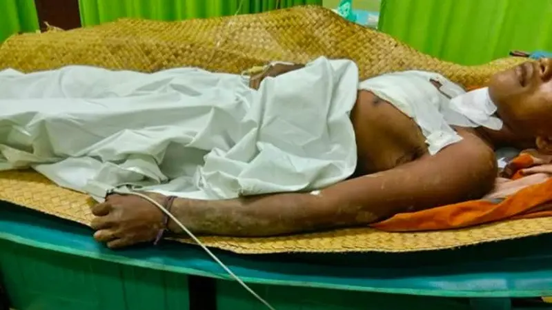 Kepala dusun di Indragiri Hulu kritis usai diterkam buaya dirawat di rumah sakit.