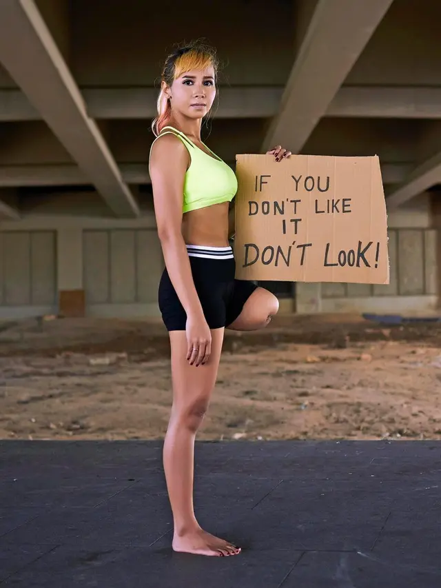 [Bintang] Kehilangan Satu kaki, Wanita Ini Sukses Jadi Seorang Model