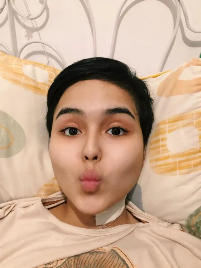 6 Potret Perjuangan Laura Anna Hadapi Spinal Cord Injury, Fisioterapis Hingga Akupuntur