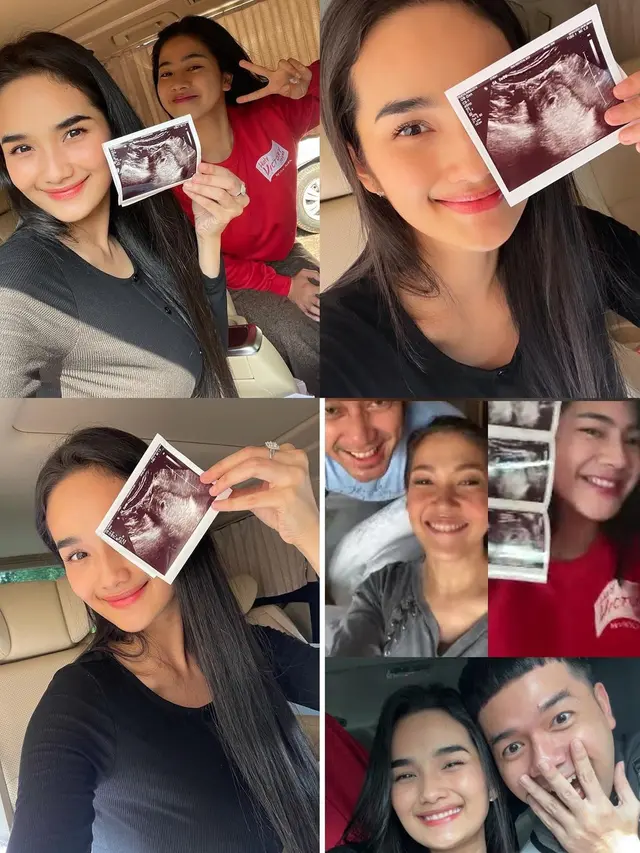 6 Momen Felicya Angelista dan Caesar Hito Umumkan Hamil Anak Pertama