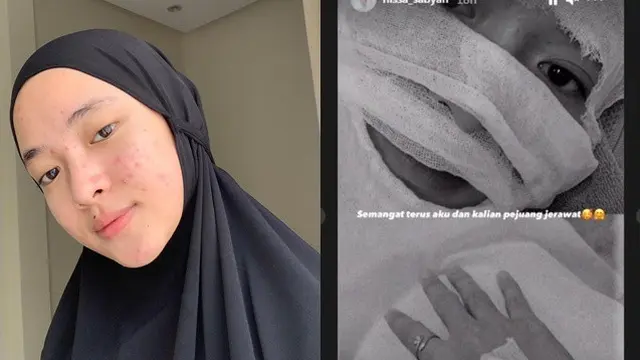 Unggah Foto Wajah Diperban dan Disebut Oplas, Ini 7 Potret Transformasi Nissa Sabyan