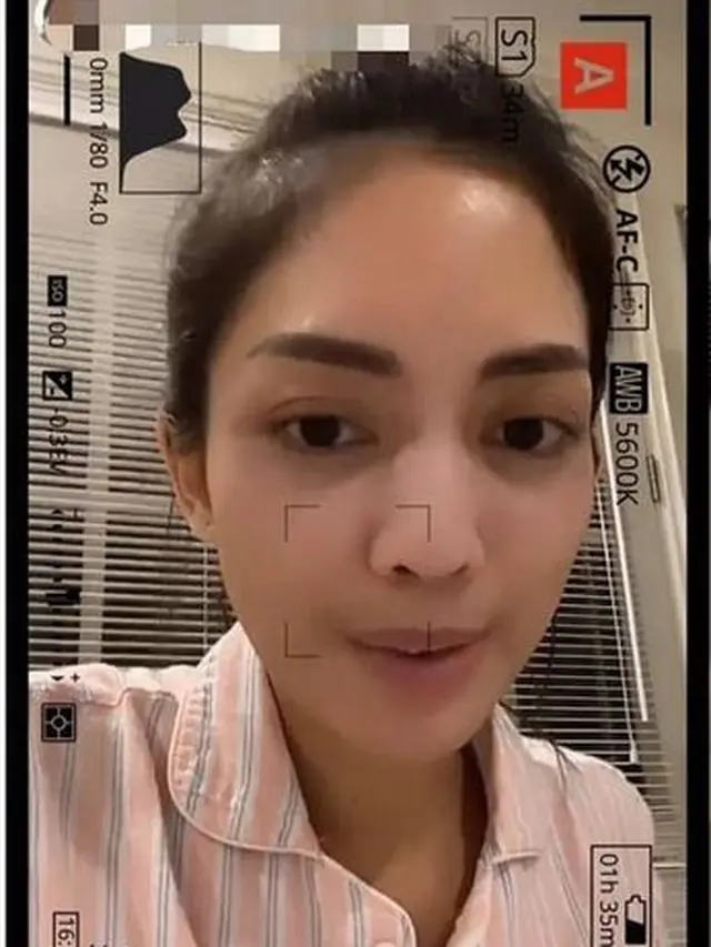 6 Potret Ririn Dwi Ariyanti Tanpa Makeup, Tampil Natural