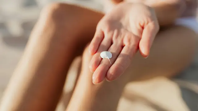 Beresiko Kanker Kulit