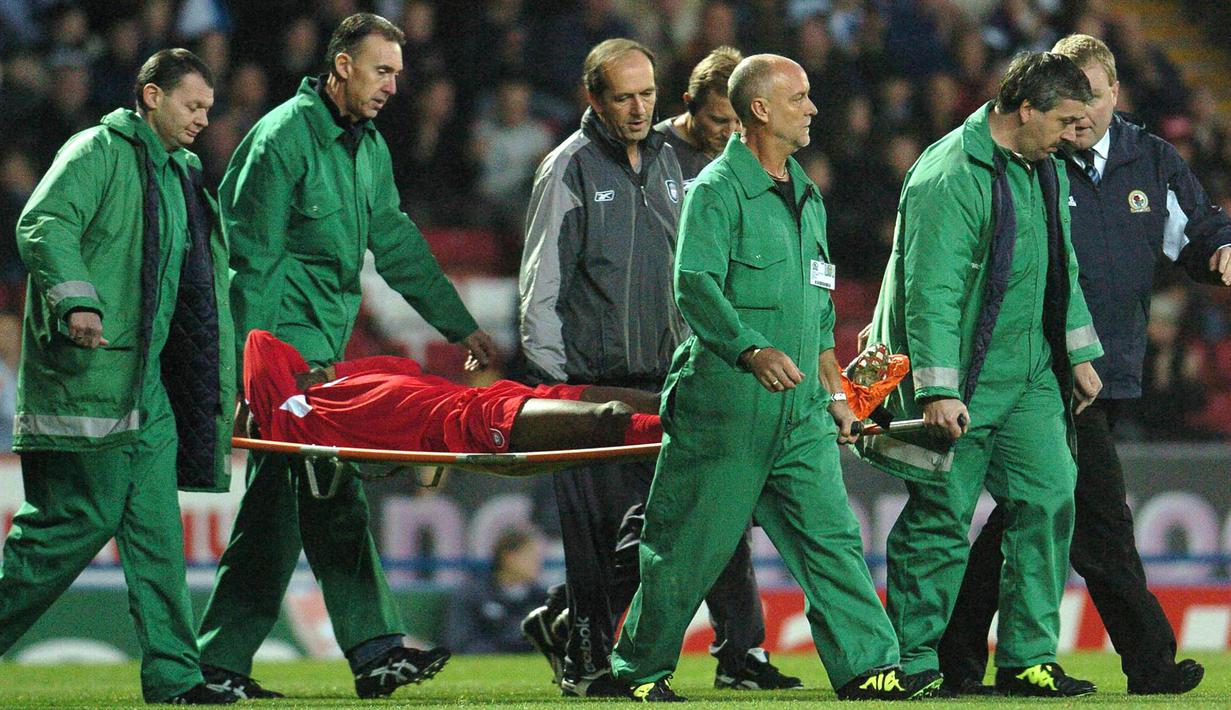2. Djibril Cisse (Liverpool) - Cedera patah tulang tibia dan fibula saat melawan Blackburn yang membuatnya harus absen tujuh bulan. (AFP/Paul Barker)