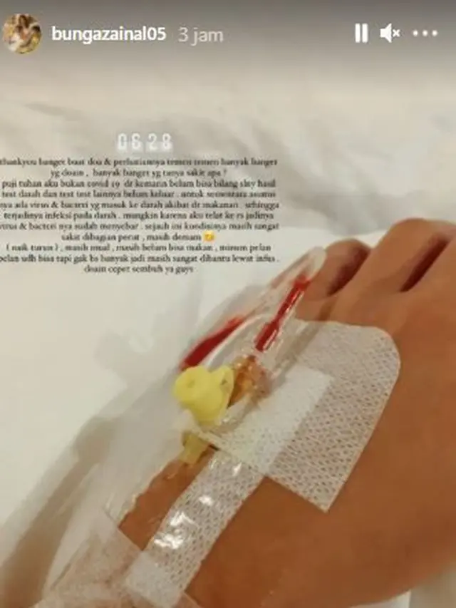 Bunga Zainal alami sakit