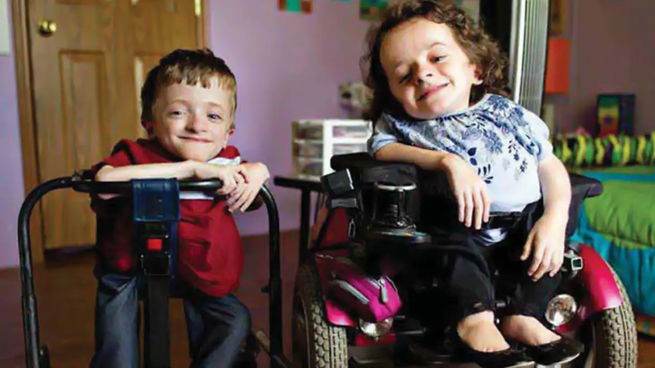 osteogenesis-imperfecta-131118b.jpg