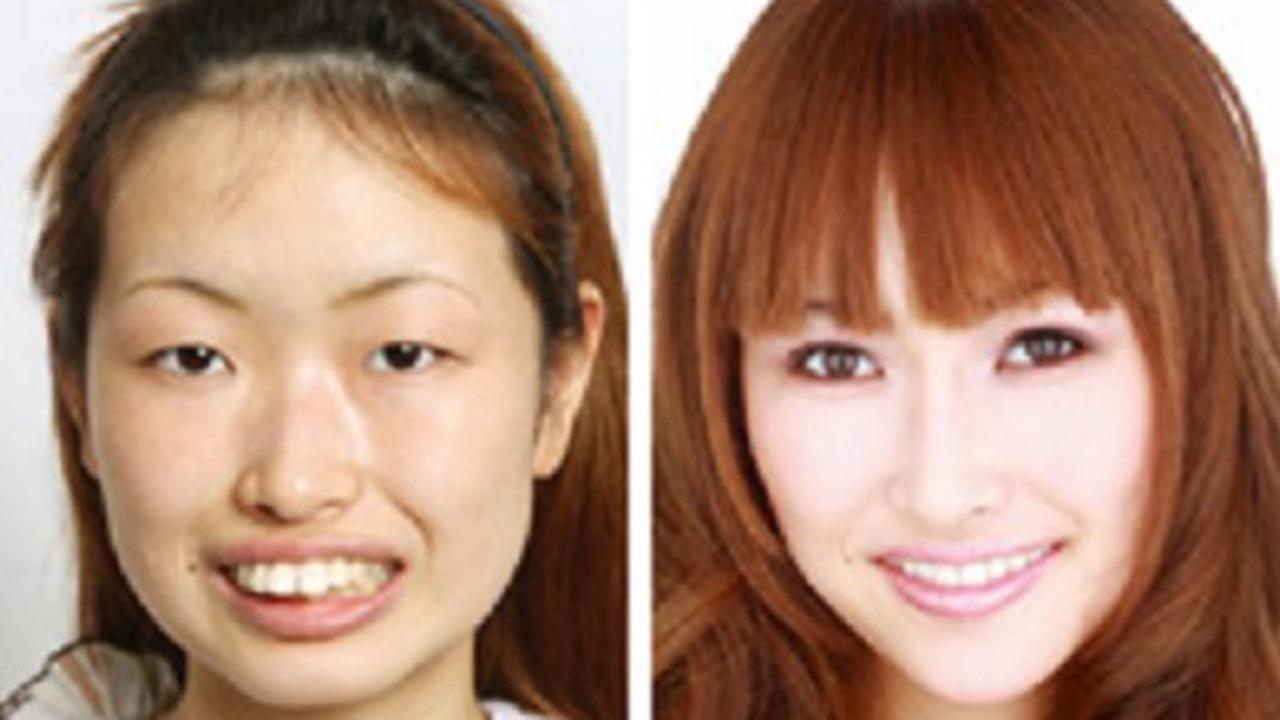 Korean Plastic Surgery