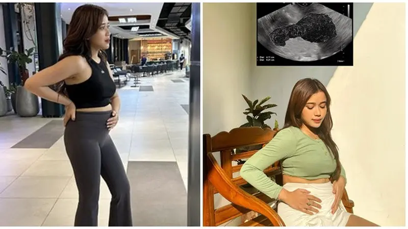 Buka Suara Soal Kabar Hamil, Ini 6 Potret Brisia Jodie Pakai Crop Top Pamer Perut