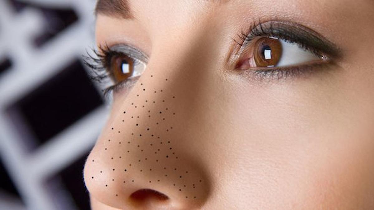 17 Cara Alami Menghilangkan Komedo Hitam dan Putih di Hidung dengan