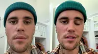 4 Fakta Justin Bieber Alami Kelumpuhan Wajah, Batalkan Beberapa Konser