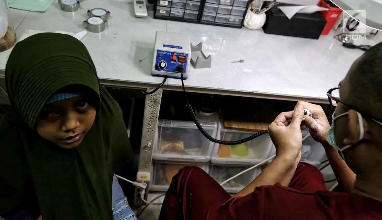 Seorang pasien anak sedang menunggu pemasangan bola mata palsu di Klinik Ilyarsi Okularis, Villa Bintaro Indah, Tangsel, Selasa (15/5). Pembagian 23 mata palsu gratis merupakan donasi dari 8 anak perusahaan BUMN. (Liputan6.com/Fery Pradolo)
