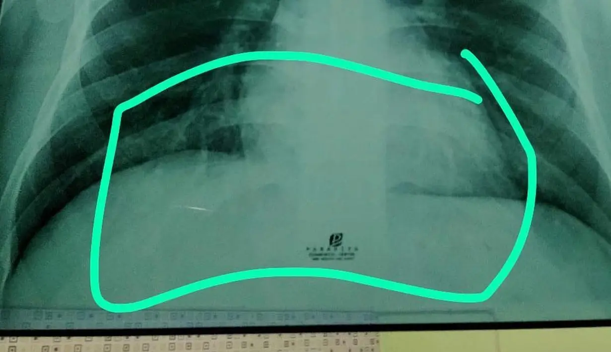 Via Vallen (Instagram/viavallen)