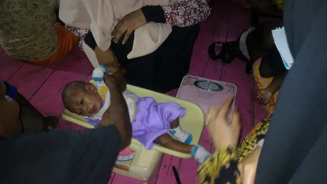 Pengukuran berat badan anak yang mengalami gizi buruk di Asmat