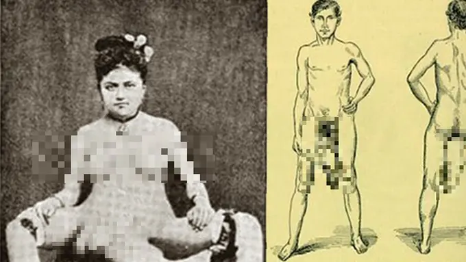 Foto: Copyright HyperVocal