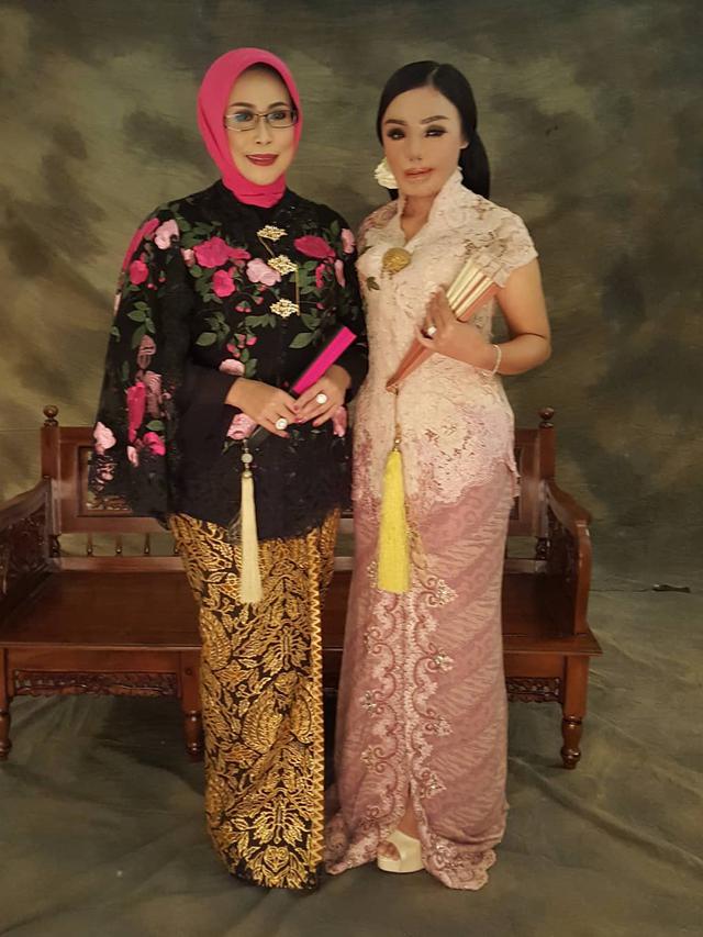 6 Potret Terbaru Lisa, Korban Penyiraman Air Keras Kini Jadi Pengusaha Perhiasan