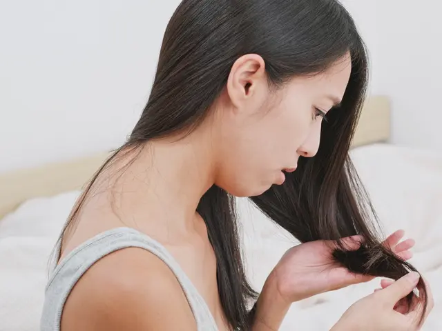 Cara Mengatasi Ketombe Rambut Rontok Yang Membandel Dan Gatal Secara Alami Beauty Fimela Com