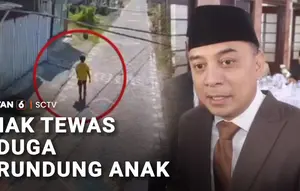 Bocah dengan "Down Syndrome" Tewas di Surabaya, Dugaan Perundungan Disorot