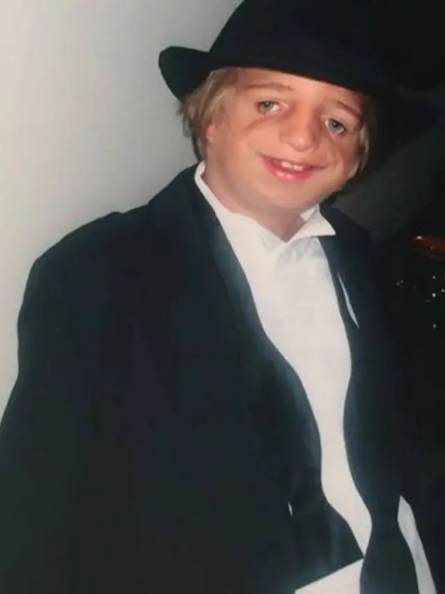 [Bintang] Punya Kelainan Genetik, Pria Ini Kerja Keras Supaya Orang Sepertinya Tak Lagi Dibully