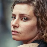 Ilustrasi kulit kusam. (Foto: Unsplash/Velizar Ivanov)