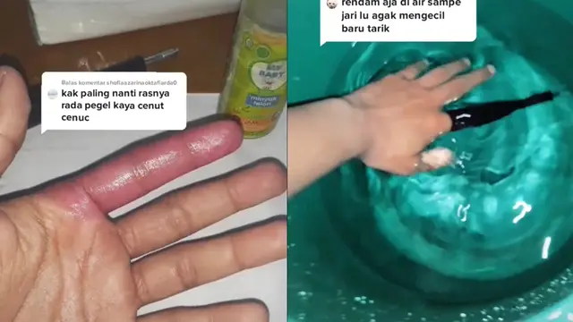 Jari Telunjuk Tersangkut di Tripod