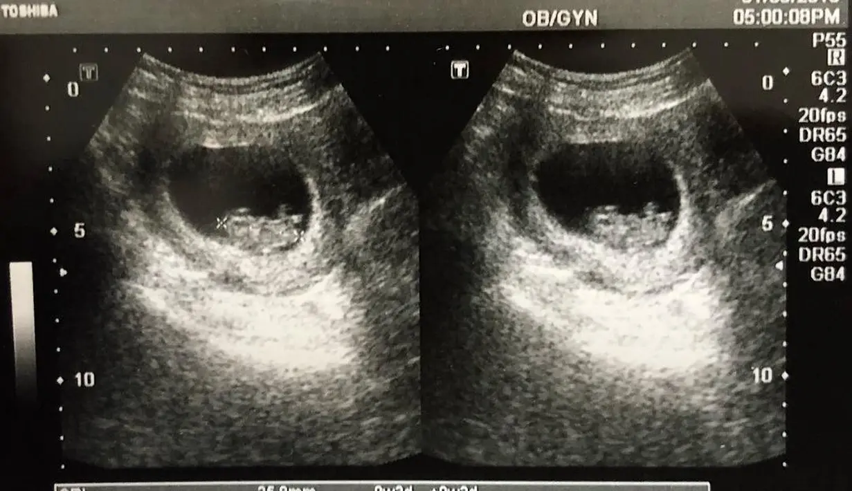 Desta dan Natasha Rizki