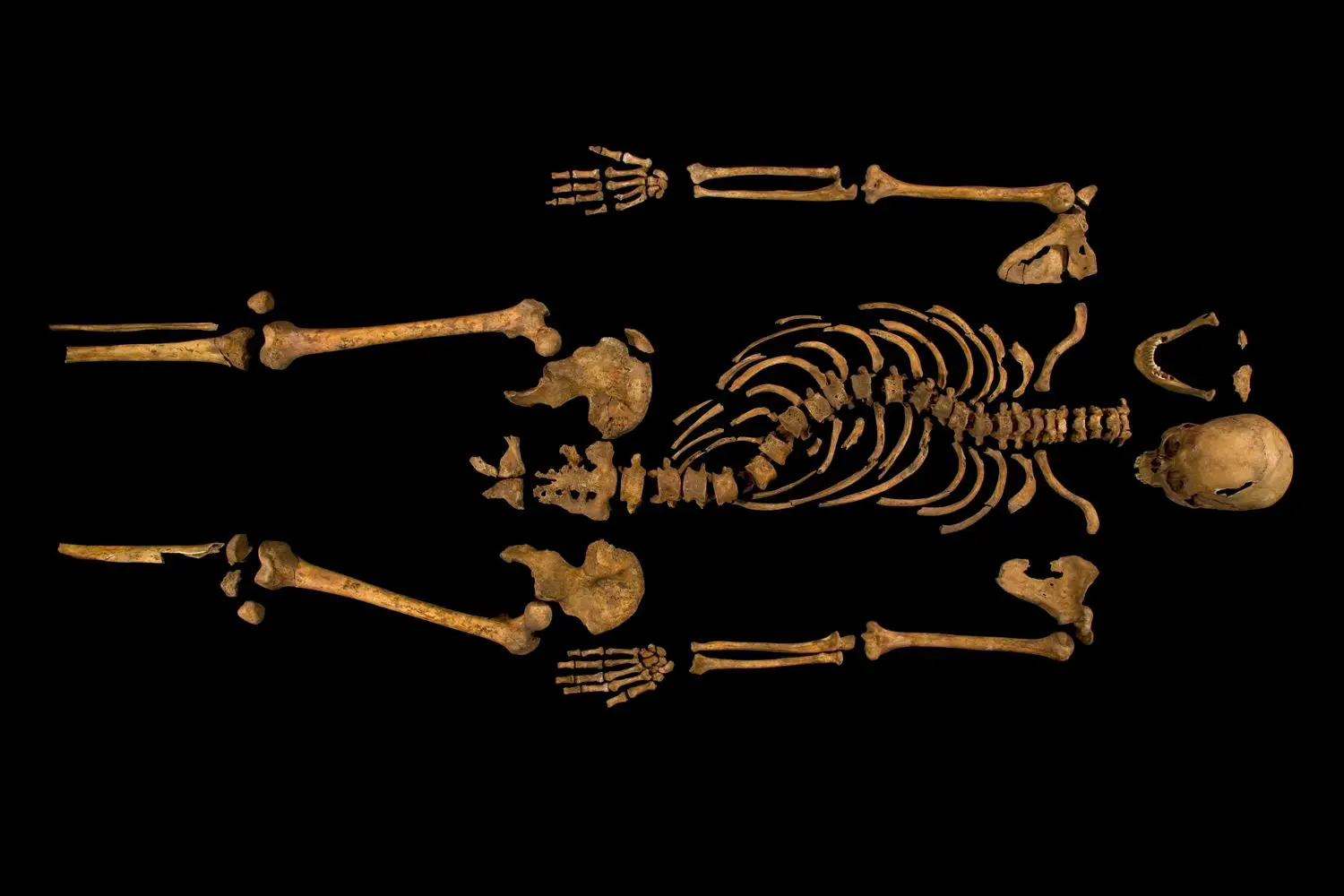 Tulang Belulang Raja Richard III