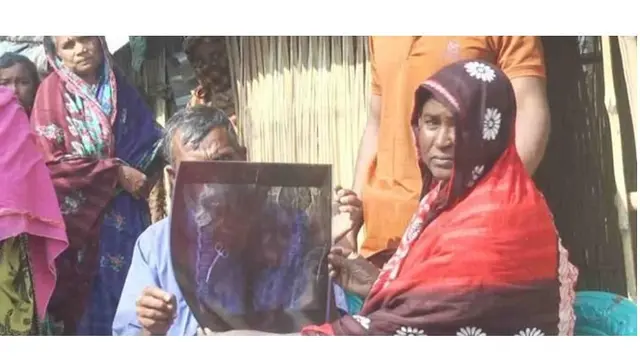 Wanita Ini 20 Tahun Hidup dengan Gunting Bedah di Tubuh, Sering Keluhkan Sakit Perut