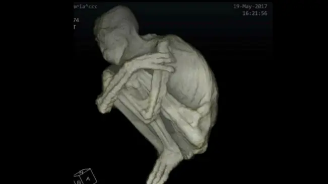 Pemindaian CT pada temuan mumi humanoid berjari 3 di Peru. (Sumber YouTube/Gaia) 