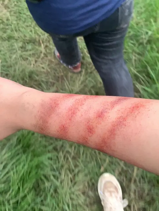 Banyak yang berkomentar sepertinya luka di tangan hingga kaki Syifa Hadju bukan makeup dan memang sungguhan luka. Terlepas dari fakta di lapangan, semangat Syifa Hadju demi syuting Jailangkung: Sandekala memang harus diacungi jempol. Selalu memberikan yang terbaik di setiap project, mulai dari film, sinetron hingga web series, tak heran jika namanya makin bersinar. (Liputan6.com/IG/@syifahadjureal)