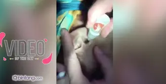 Kelabang Keluar dari Kuping Anak Kecil Ini