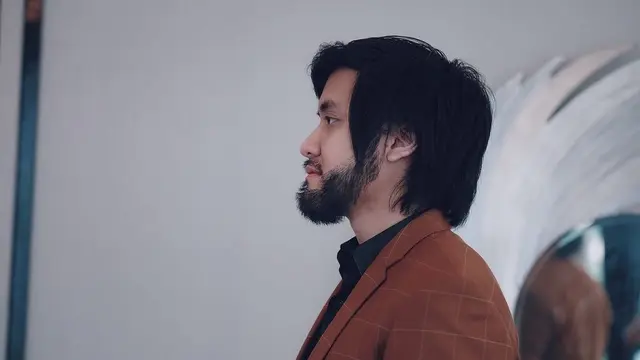 6 Potret Terbaru Kevin Aprillio Usai 7 Bulan Transplantasi Rambut, Makin Maskulin