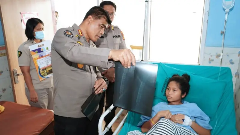 Kabid Humas Polda Riau Kombes Sunarto memperlihatkan kondisi tulang Mita di Rumah Sakit Bhayangkara.