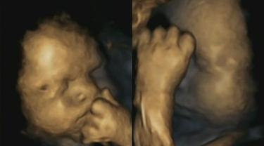 Begini Wajah Janin Dalam Kandungan Saat Ibunya Merasa Sedih Parenting Fimela Com