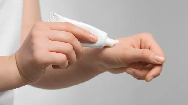Tips Menghilangkan Bekas Luka Menghitam yang Ada Pada Tubuh, Yuk Jadikan Kulit Lebih Mulus
