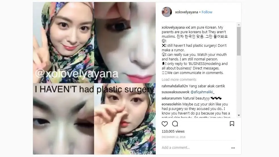 Ayana Jihye Moon tegas bantah tuduhan operasi plastik [foto: instagram.com/xolovelyayana]