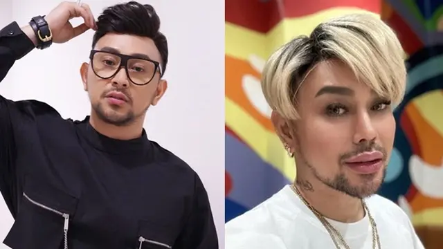Termasuk Deddy Corbuzier, Perubahan Dagu 5 Artis Pria Ini Juga Jadi Sorotan