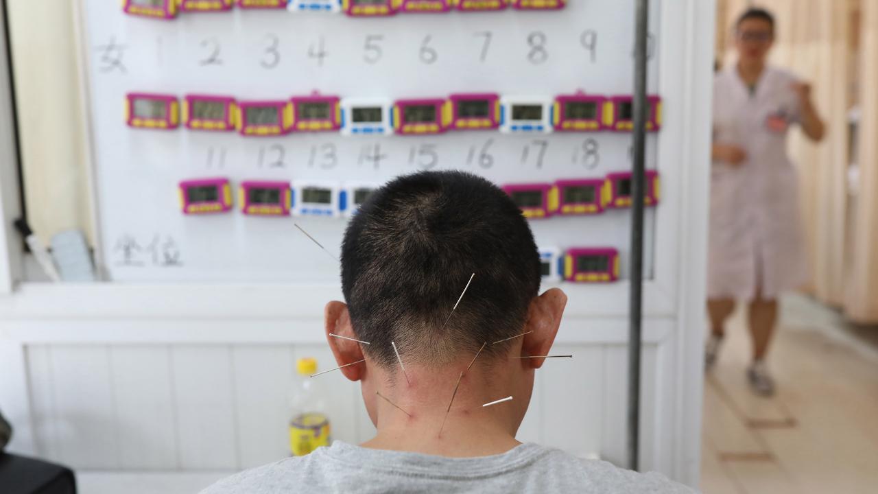 Akupunktur Laser, Opsi Terapi Berbagai Keluhan Kesehatan bagi Si Pembenci Jarum