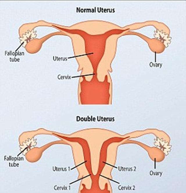 Perbedaan kondisi organ intim, leher rahim dan rahim normal dengan milik Faye | Photo: Copyright dailymail.co.uk