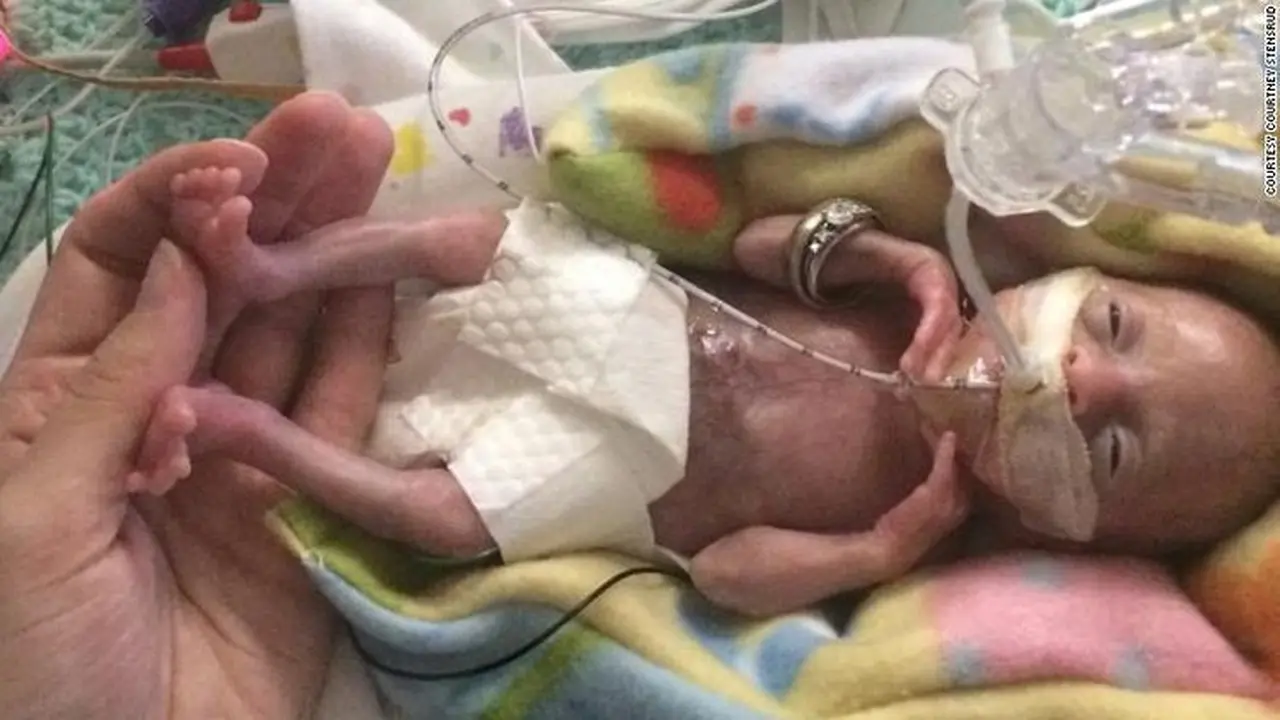 Penuh Keajaiban, Bayi Prematur 21 Minggu Selamat Berkat Cinta Ibu