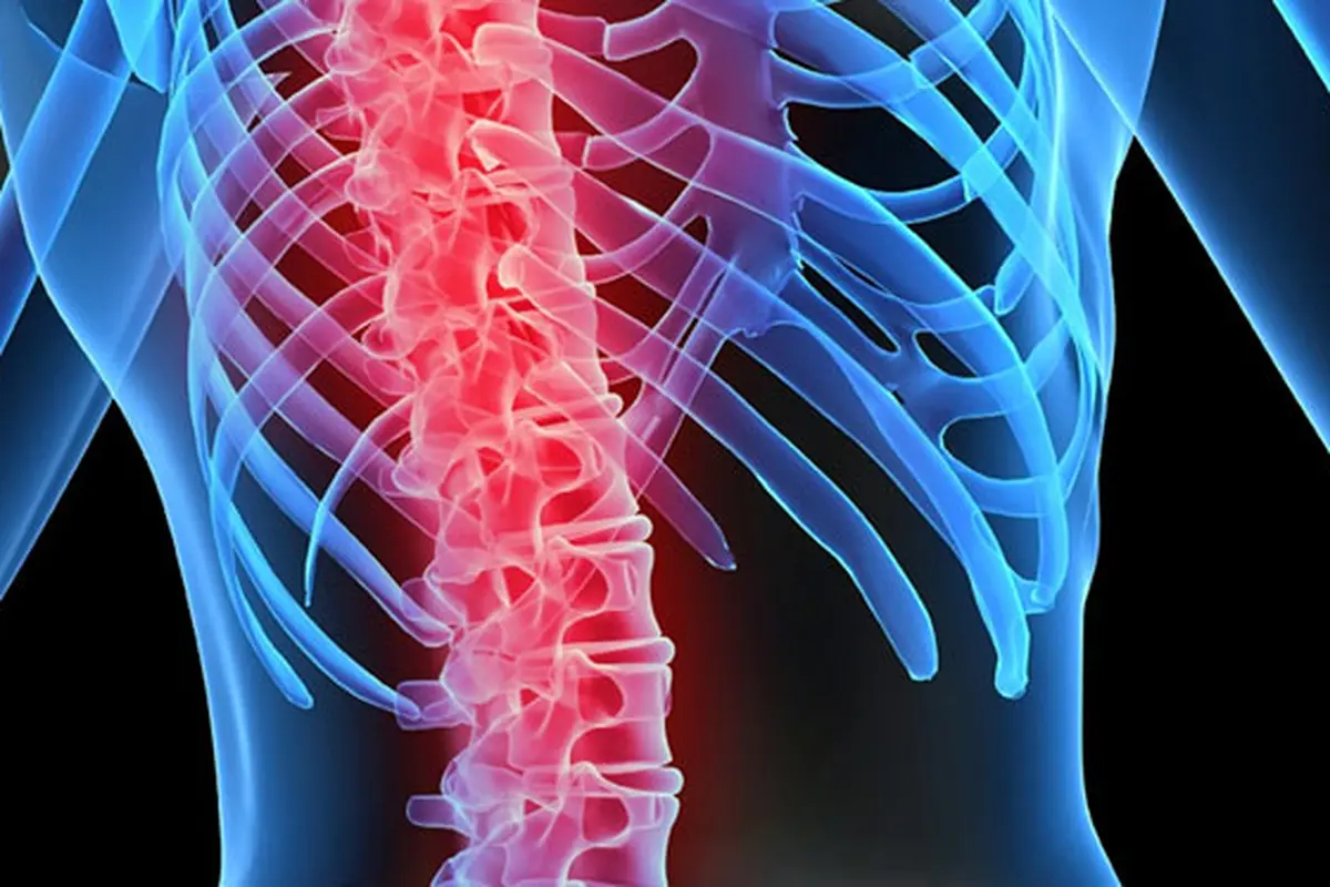 osteoporosis-tulang-131101b.jpg