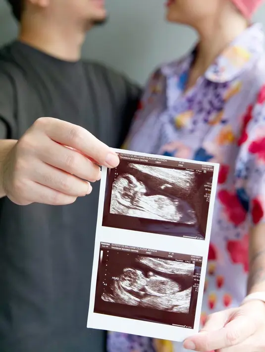 Derby Romero dan Claudia Adinda (Instagram/derbyromero)